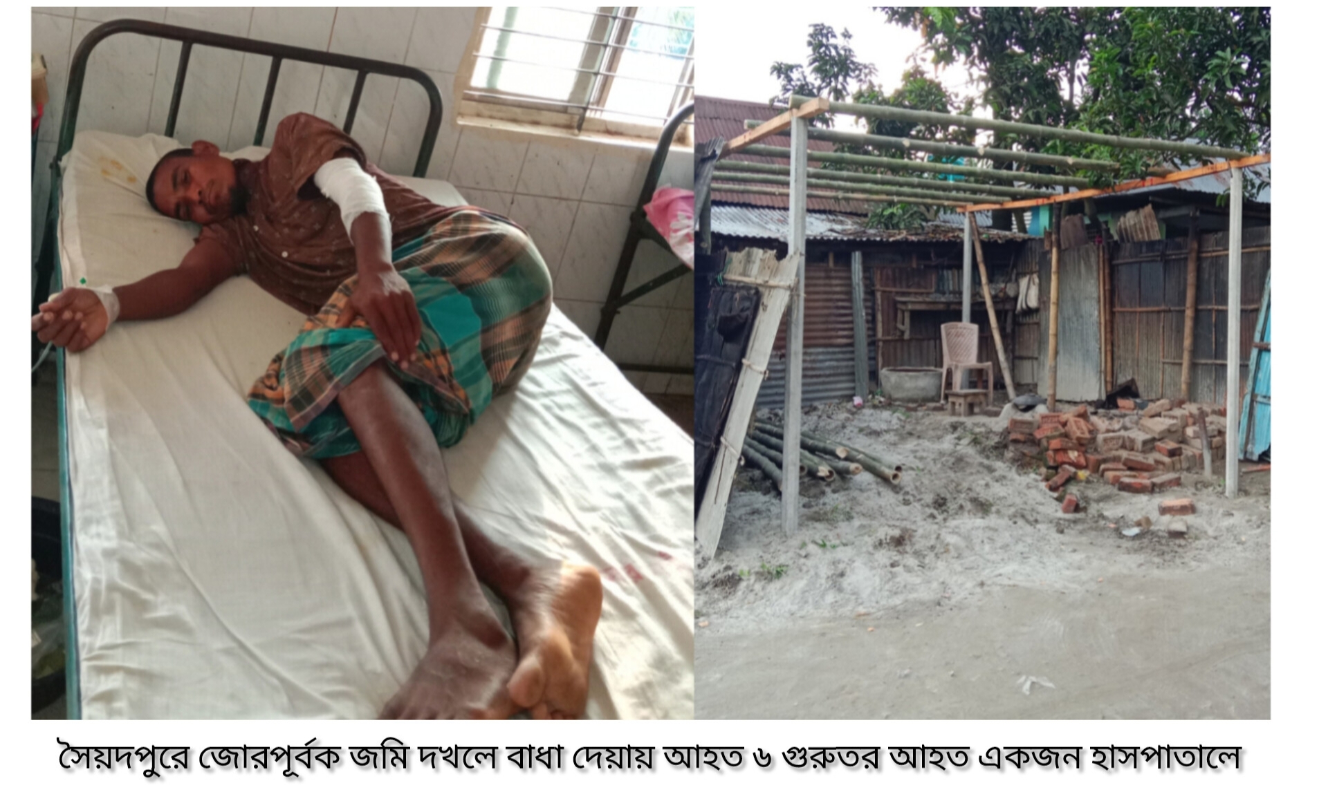 সৈয়দপুরে জোরপূর্বক জমি দখলে বাধা দেয়ায় আহত ৬ গুরুতর আহত একজন হাসপাতালে