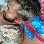 গাইবান্ধার সাদুল্লাপুরে সাংবাদিকের উপর সন্ত্রাসী হামলা