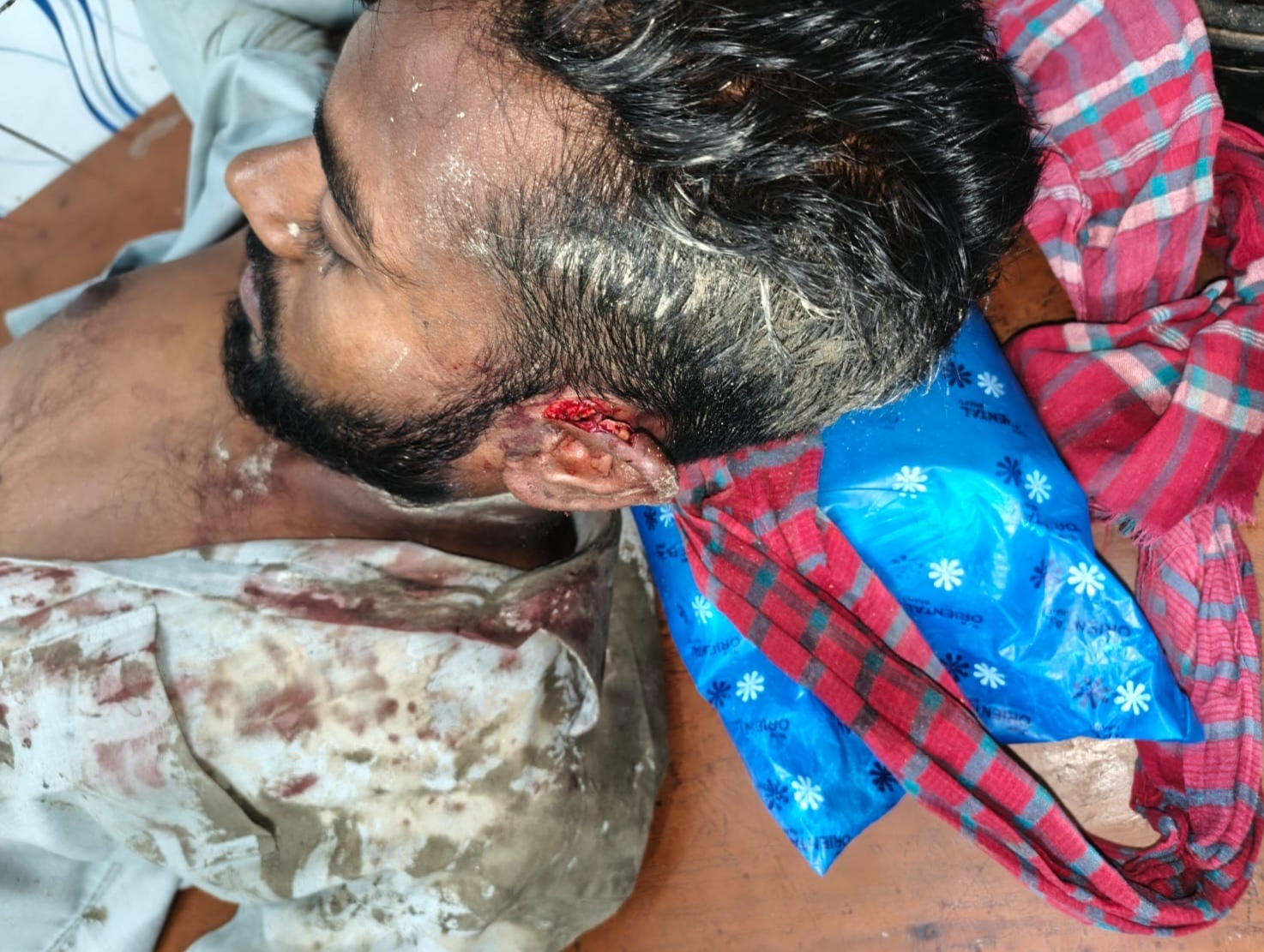 গাইবান্ধার সাদুল্লাপুরে সাংবাদিকের উপর সন্ত্রাসী হামলা