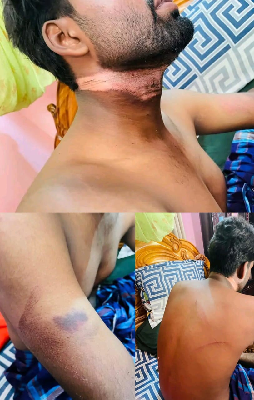 ডাকাতের ডাকাতি এটা এখন ধাপেরহাট ইউনিয়ন নিত্য দিনের সাধারণ বিষয় হয়ে দারিয়েছে।