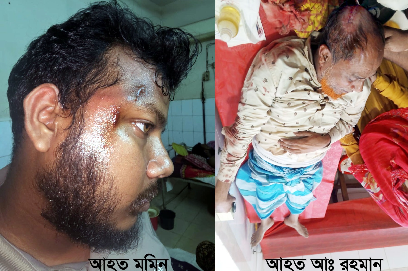 রায়গঞ্জে জমি সংক্রান্ত বিরোধকে কেন্দ্র করে সংঘর্ষ : আহত-৫